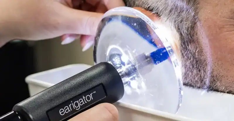 Earigator being used to clean out an ear