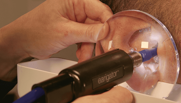 Earigator being used to clean out an ear